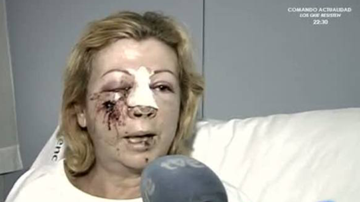 España Directo - Detenido un joven que lanzaba piedras contra vehículos