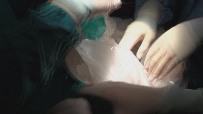 Telecanarias - 14/01/15 | Ver