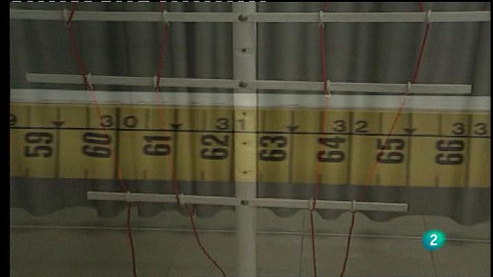 Para todos La 2 - La anorexia