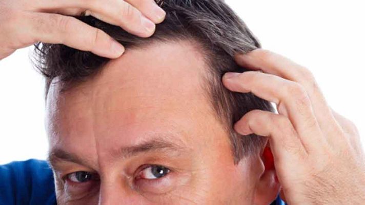 La mañana - Lo último para la caída del cabello