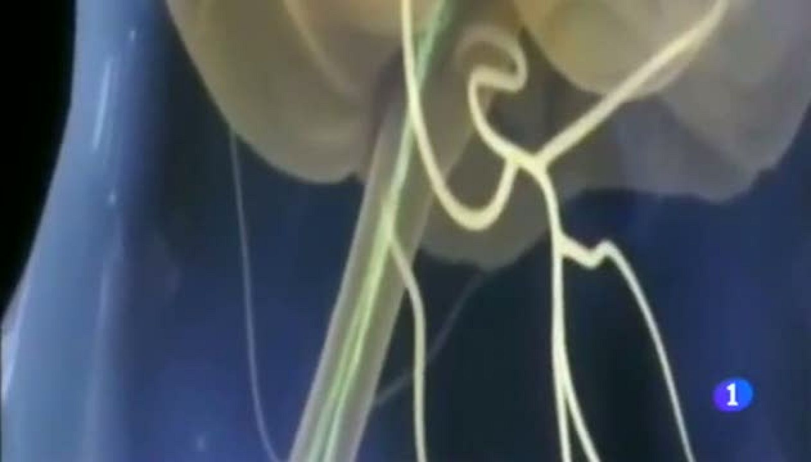 VOLVER A CAMINAR - 18/02/2015 | Ver