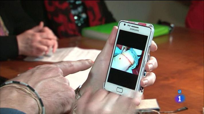 Comando Actualidad - Afectados cinta gástrica