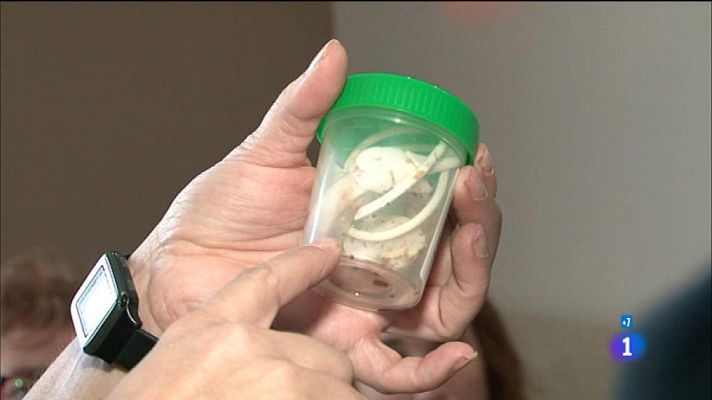 Comando Actualidad - La cinta gástrica