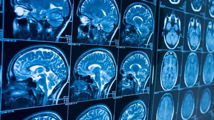 La mañana - Cerebro saludable