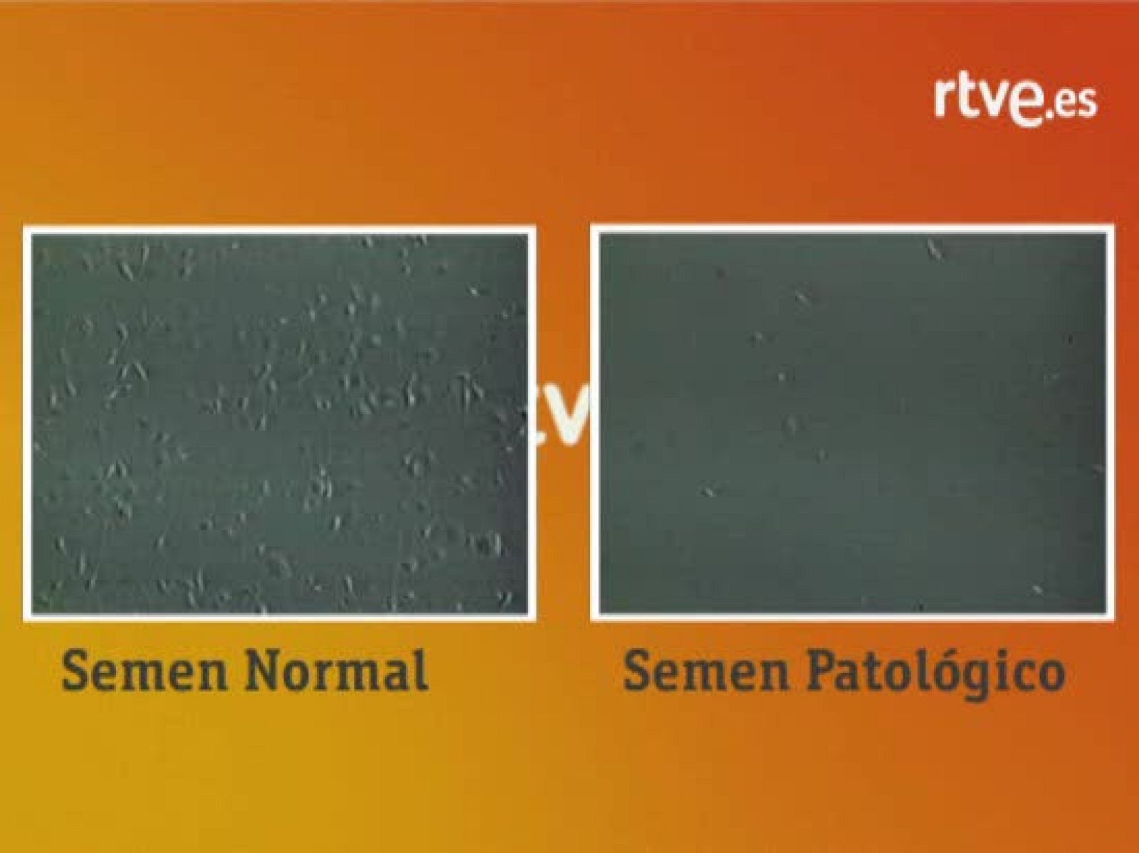 Cómo es el semen normal y el patológico - Ciencia y tecnología en Rtve.es | Ver