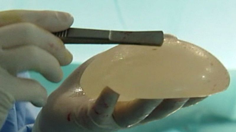 Francia estudia la relación de las prótesis mamarias con la aparición de cáncer