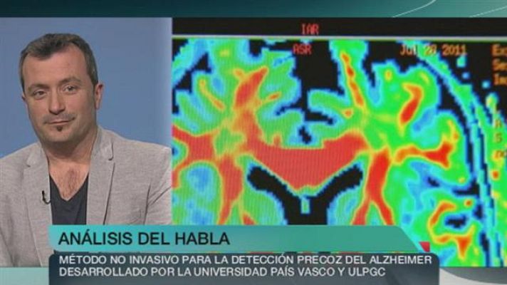 +Canarias - + Canarias - 23/03/15