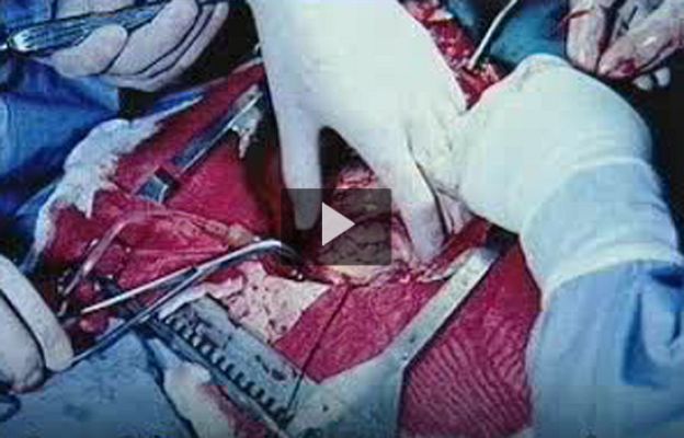 Ciencia y tecnología en Rtve.es - Fumar provoca cáncer