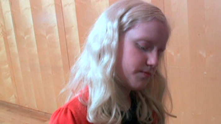 España Directo - Así es el día a día de un albino