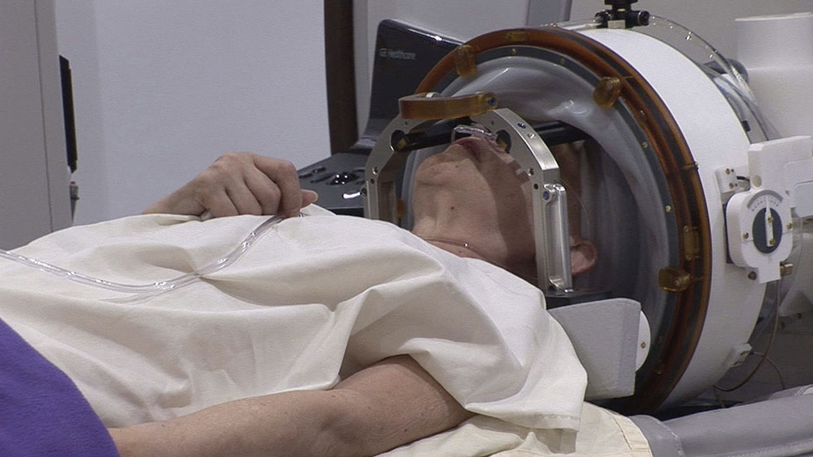 España realiza con éxito la primera operación de cerebro sin abrir el cráneo | Ver