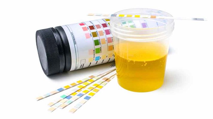 La mañana - Dolor articular y ácido úrico