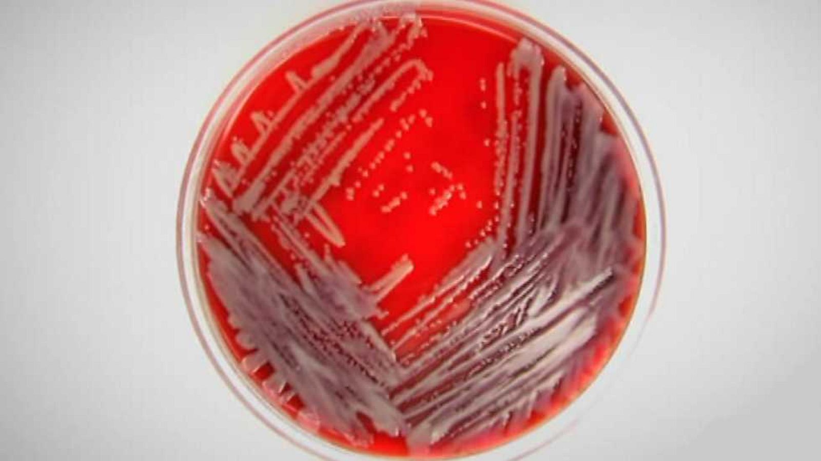 Documentos TV - Una bacteria de pesadilla - ver ahora