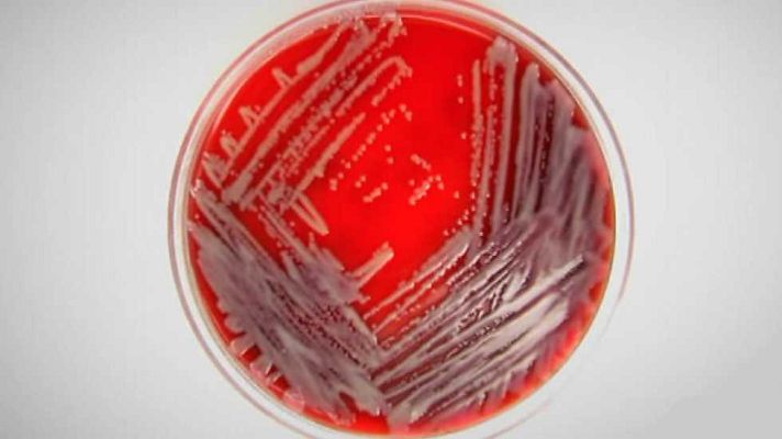 Documentos TV - Una bacteria de pesadilla