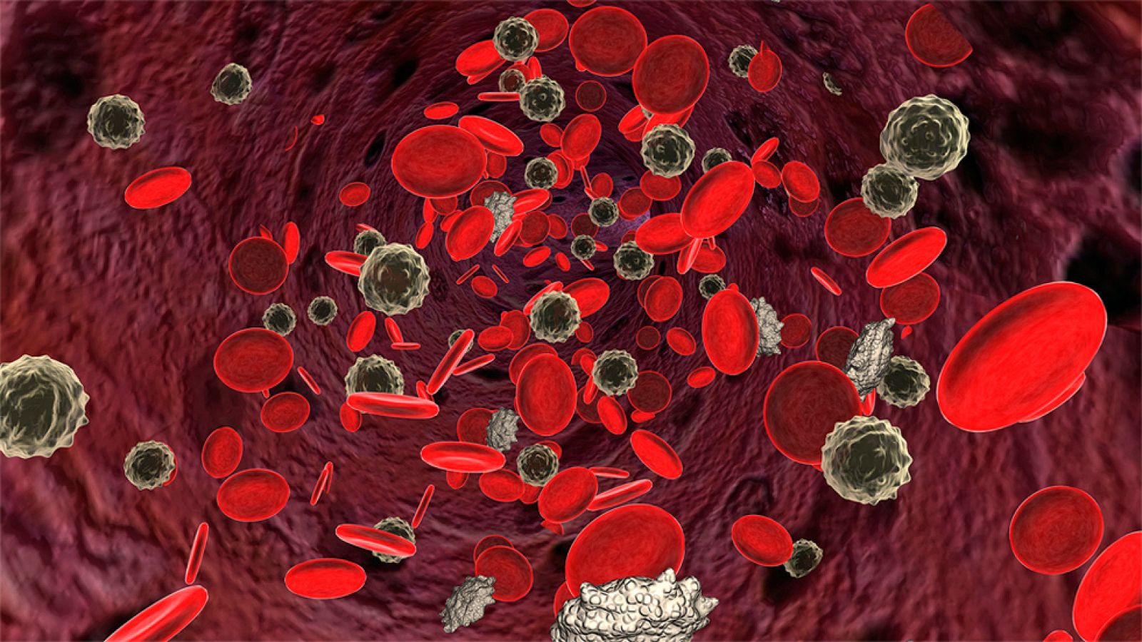 Investigadores españoles identifican los genes que mutan para provocar leucemia linfática crónica