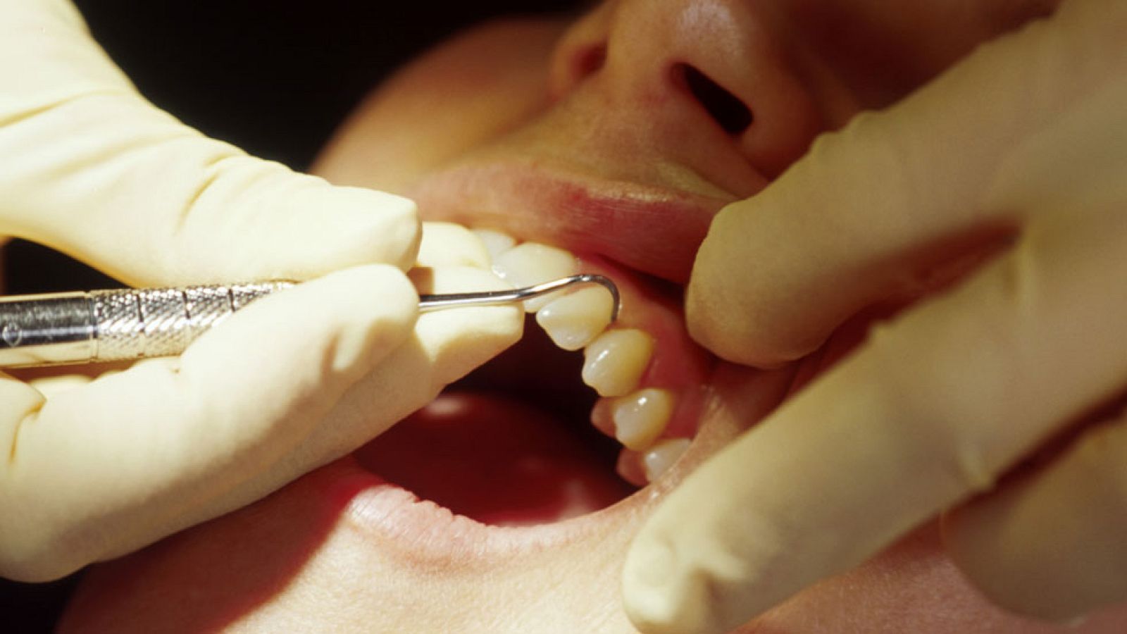 Aumentan los falsos dentistas y las denuncias por mala praxis | Ver