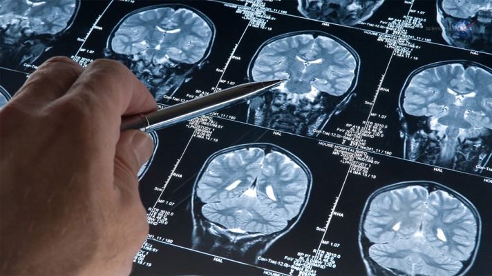 Ciencia y tecnología en Rtve.es - Se estudiará la enfermedad de Alzheimer en la ingravidez del