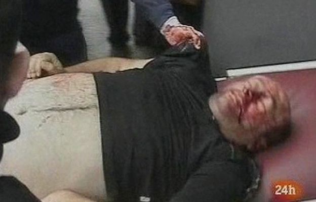  - Atentan contra un alcalde georgiano