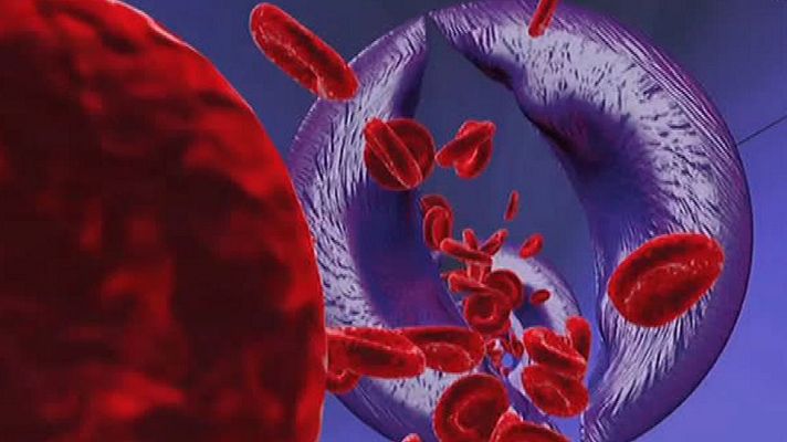 La mañana - Problemas circulatorios