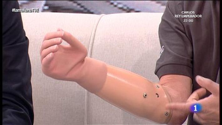 La mañana - La mañana - ¿Cómo se vive con una mano biónica?