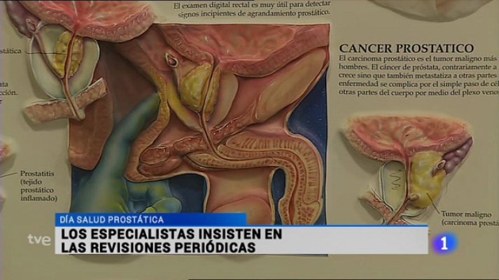 Informativo Telerioja - Telerioja en 2' - 15/09/15