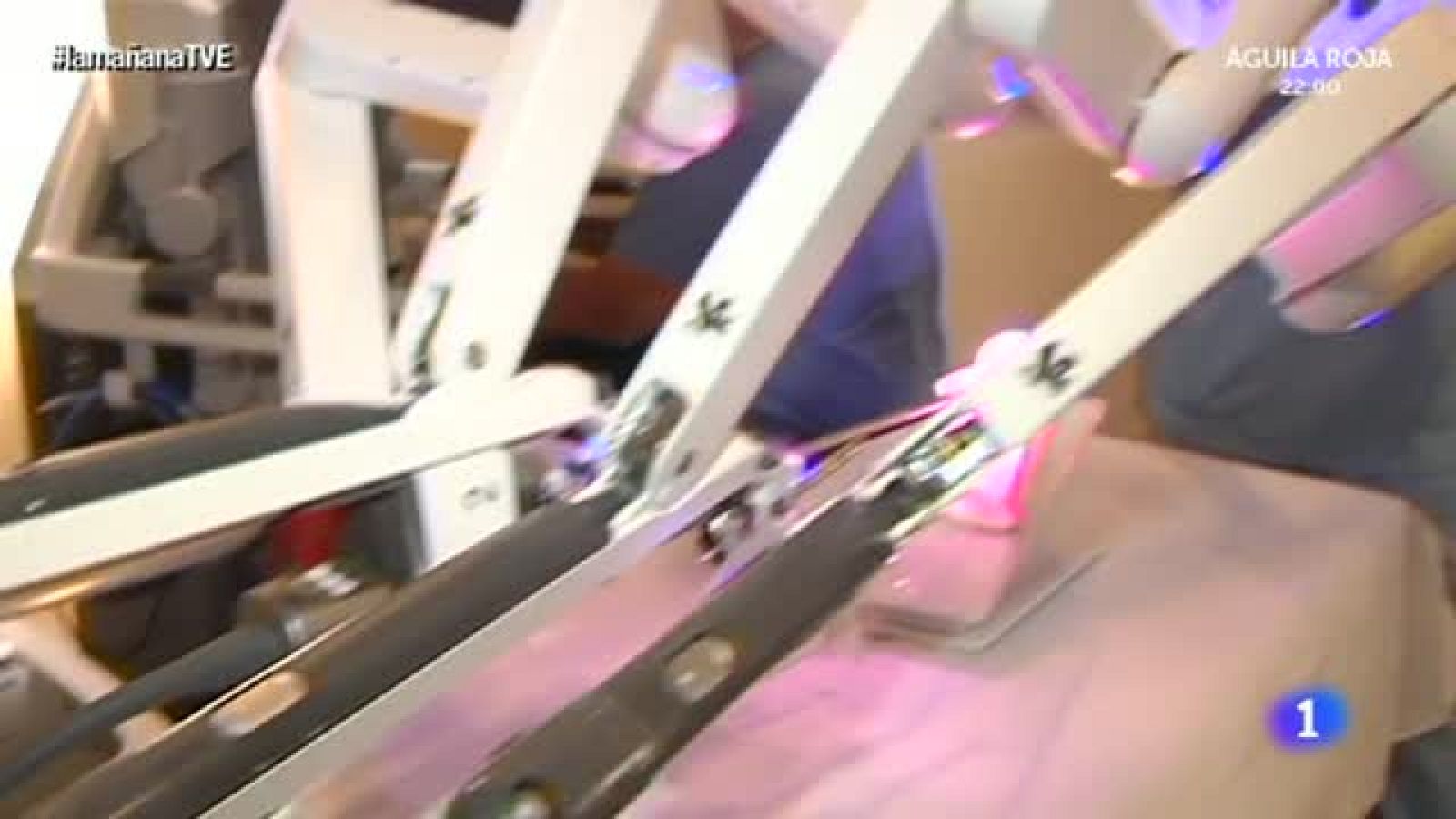 La mañana - Un robot para operar con total precisión