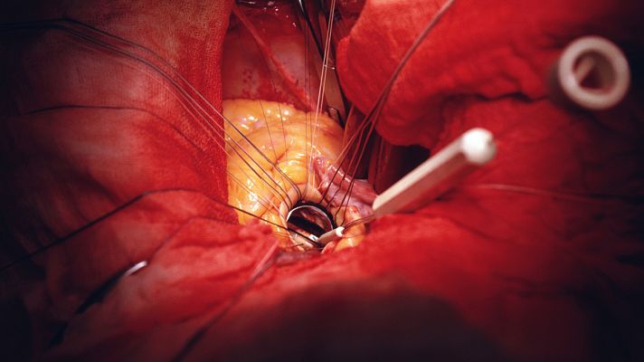 La mañana - Saber vivir - Colesterol en sangre y sus peligros