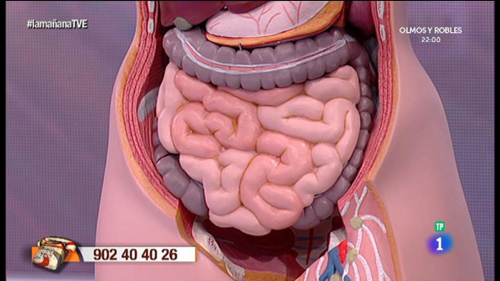Cómo evitar el estreñimiento