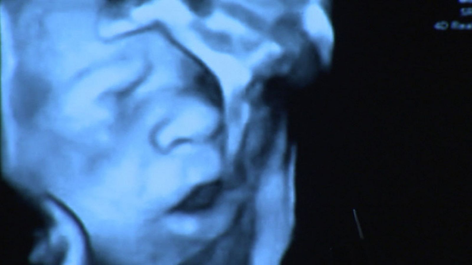 El feto percibe la música a partir de la semana 16 según una investigación en una clínica de Barcelona