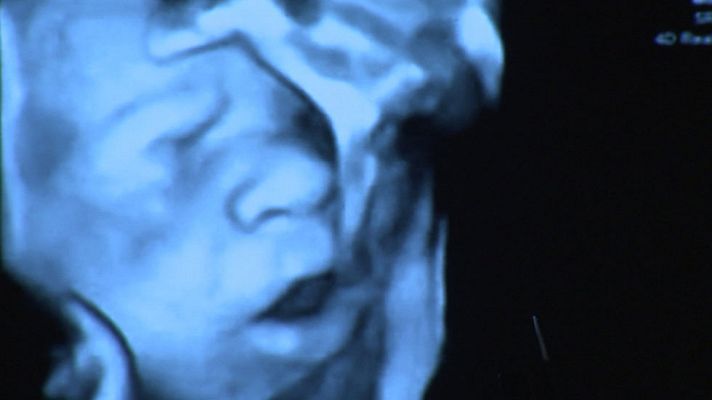 Telediario 1 - El feto percibe la música a partir de la semana 16 según una investigación en una clínica de Barcelona
