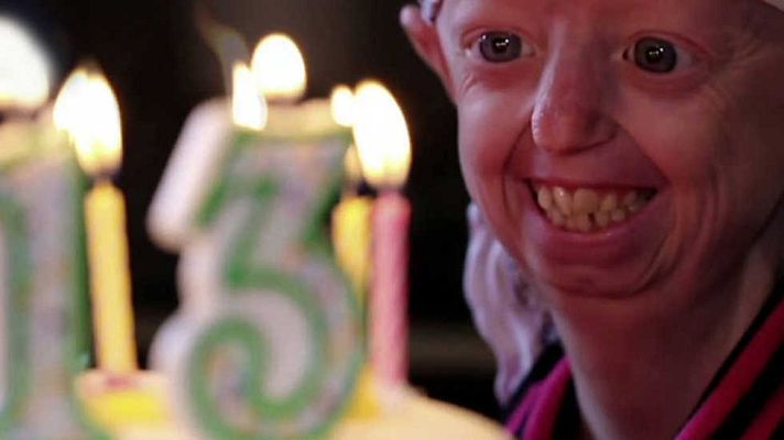 La noche temática - Hayley: la adolescente más vieja del mundo