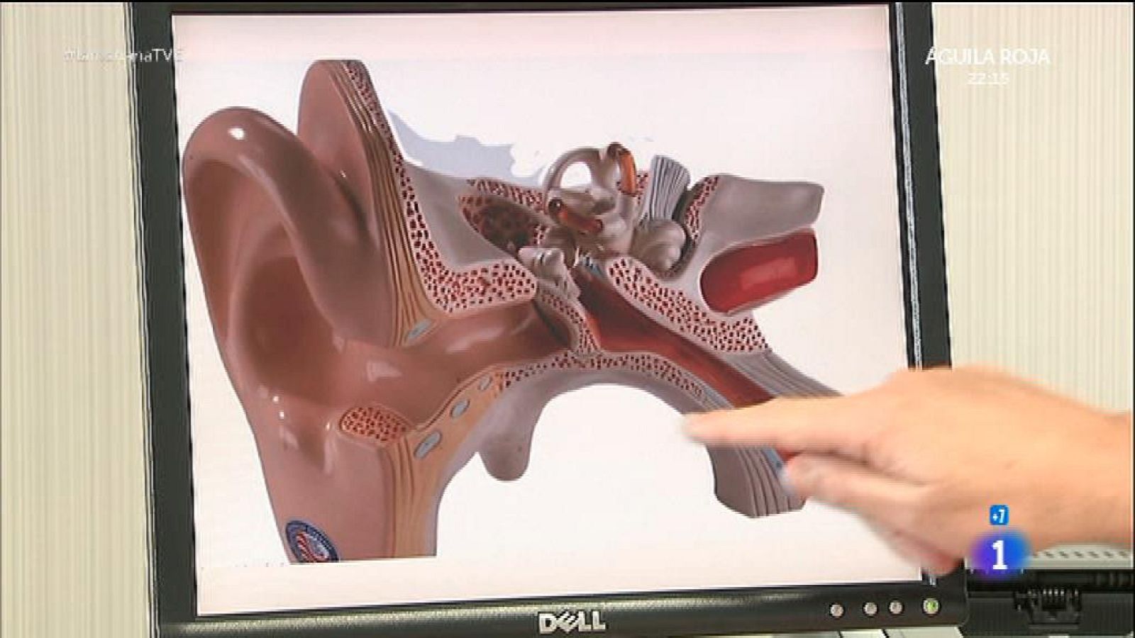 Atentos al riego cerebral y los mareos