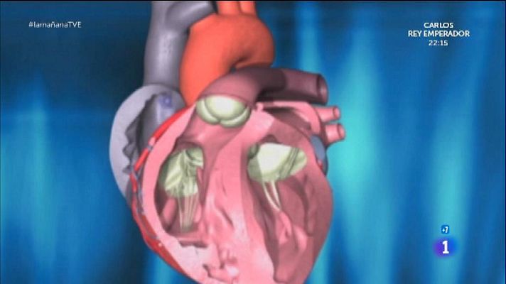 La mañana - Hablamos de válvulas cardiacas