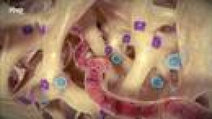  - La osteoporosis explicada en 3D