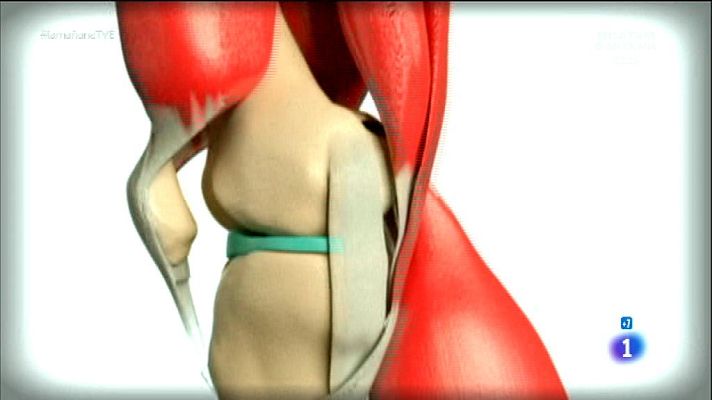 La mañana - Dolor de rodillas ¿qué hacer?