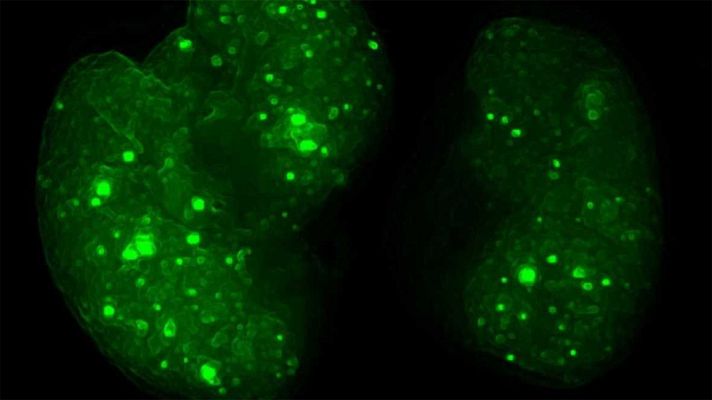 Telediario 1 - Un estudio identifica los mecanismos de la metástasis