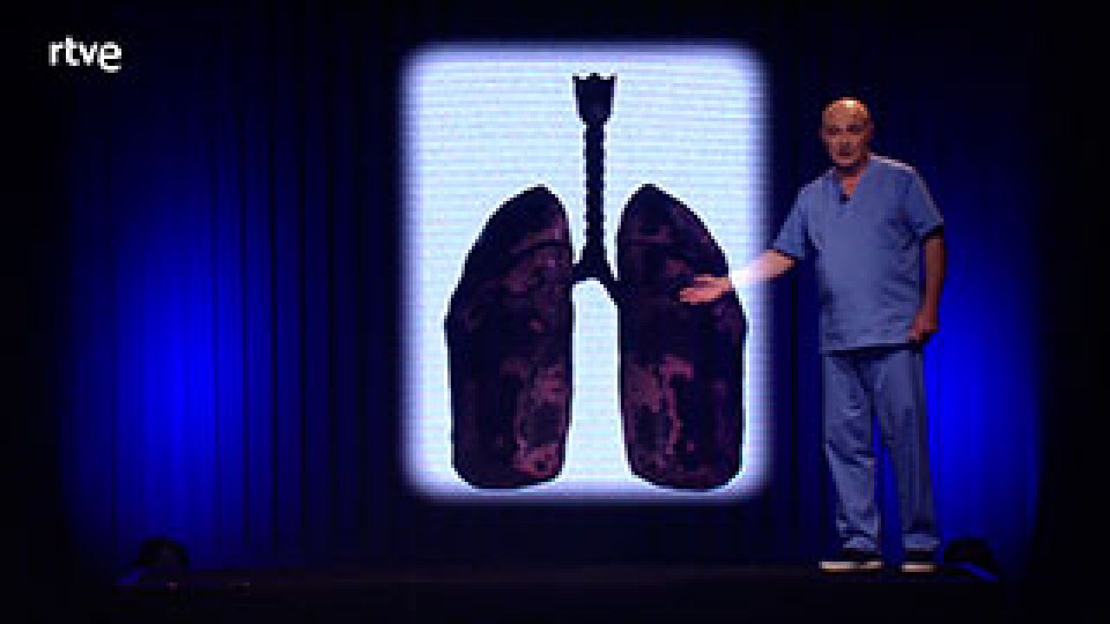  Mira cómo se quedan tus pulmones cuando fumas