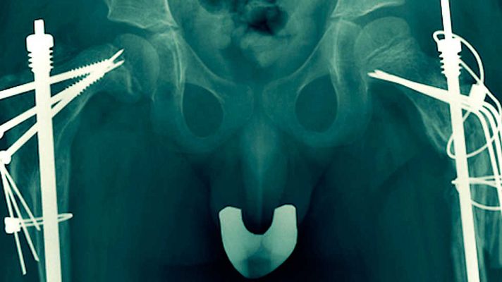 Documentos TV - Frágil, camino de cristal