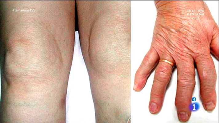 La mañana - Problemas de articulaciones en otoño