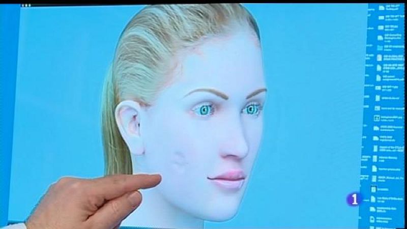 Assaig clínic per pal·liar els efectes secundaris del medicament contra el VIH