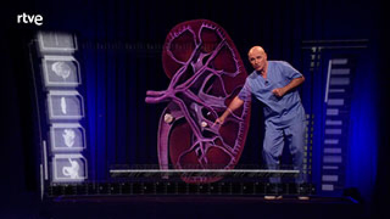  ¿Qué debes hacer si tienes una piedra en el riñón?