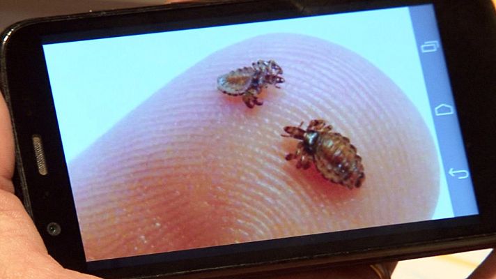 Comando Actualidad - Piojos