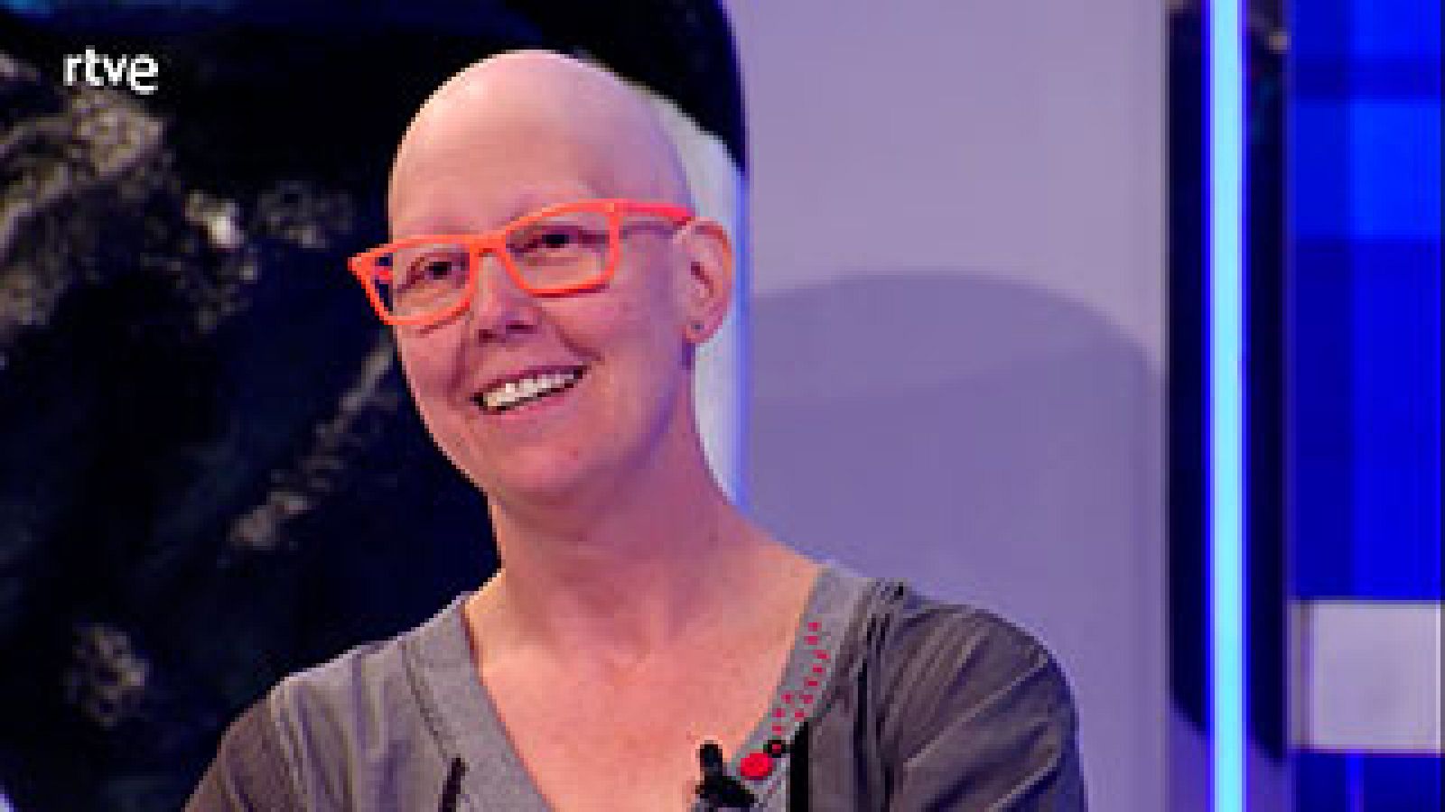  En la adolescencia perdió todo el pelo. Su viaje a EEUU le cambió la vida