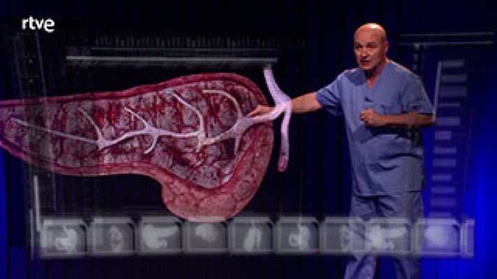  - Explicamos claramente qué es una pancreatitis