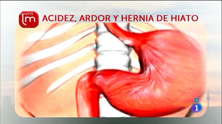 La mañana - Acidez de estómago y hernia de hiato