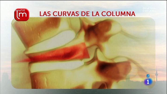 La mañana - Artrosis y dolor de espalda