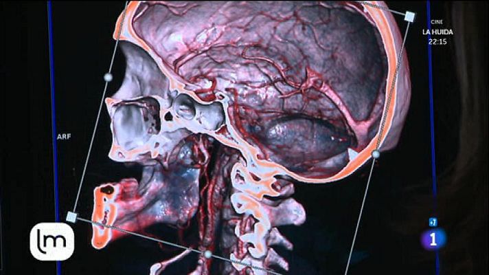 La mañana - Consejos para cuidar nuestro cerebro