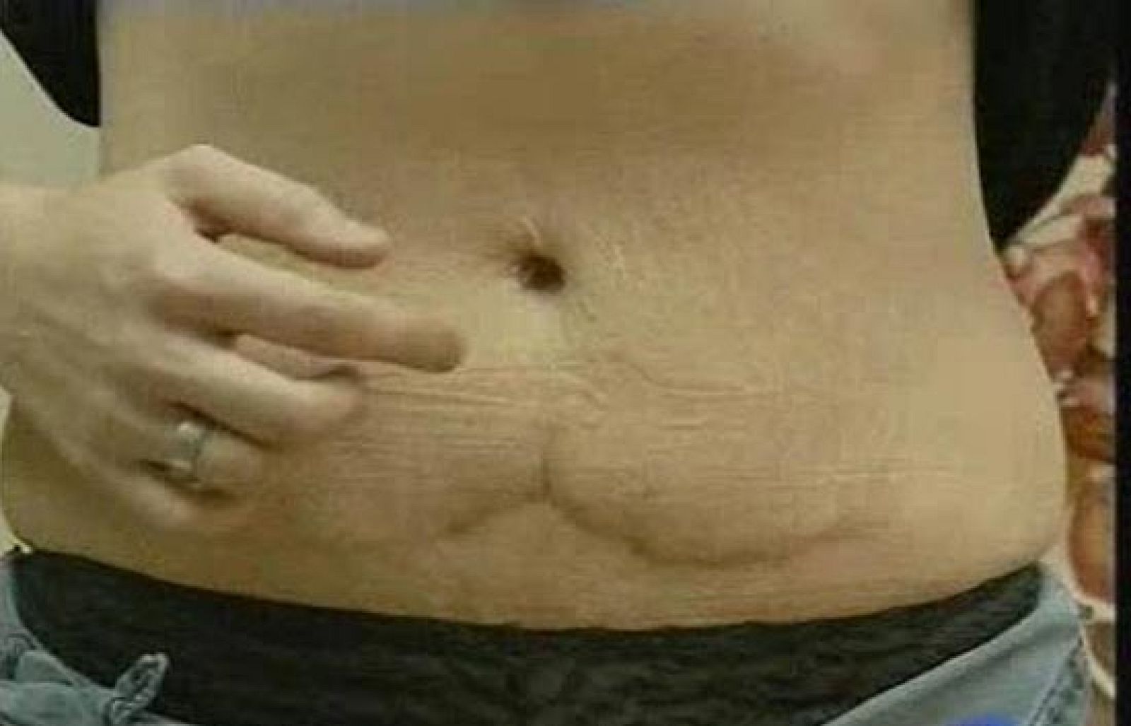 Las operaciones de cirugía estética no siempre acaban bien