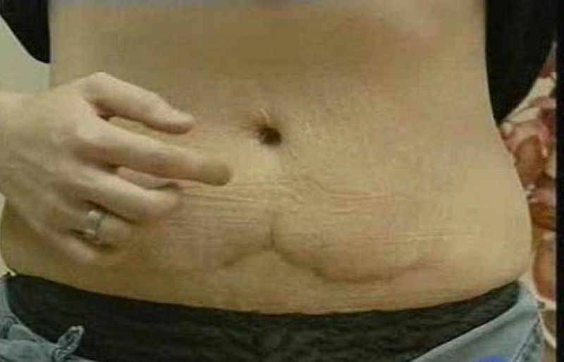 Las operaciones de cirugía estética no siempre acaban bien