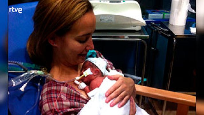  - El 55% de los prematuros logran sobrevivir sin grandes secue