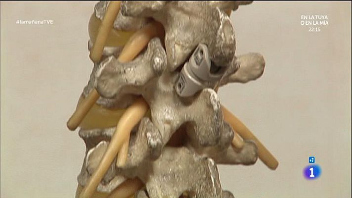 La mañana - Huesos más fuertes